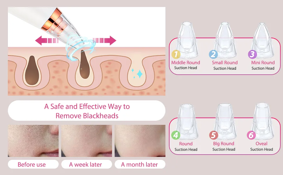 blackhead remover