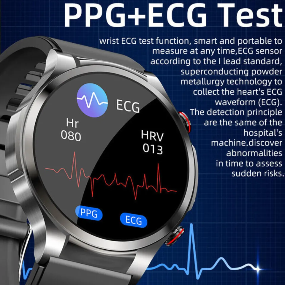 Blood Sugar Monitoring Smart Watch Sugar Smart Watch ECG PPG Heart