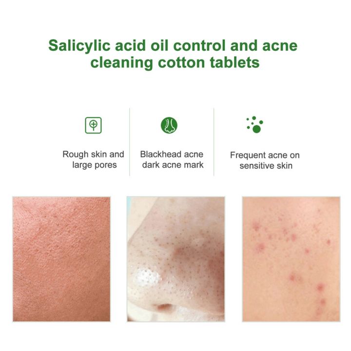 55%20pcs%20Soft%20Touch%20Pads%20Green%20Salicylic%20Acid%20Cotton%20Sheets%20Acne%20Repellent%20Shrink%20Pore%20Removal%20Blackhead%20Mask%20Salicylic%20acid%20cotton%20tablets%20-%20Image%203