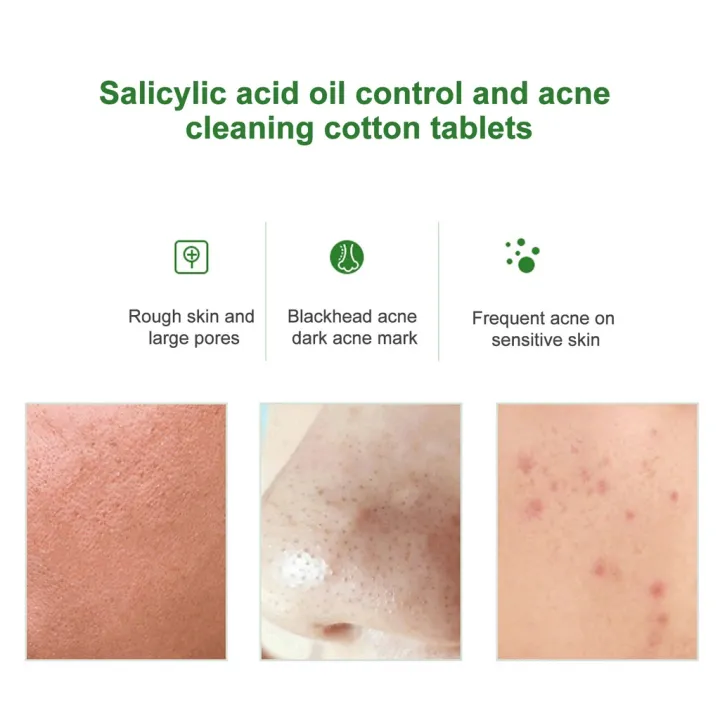 55%20pcs%20Soft%20Touch%20Pads%20Green%20Salicylic%20Acid%20Cotton%20Sheets%20Acne%20Repellent%20Shrink%20Pore%20Removal%20Blackhead%20Mask%20Salicylic%20acid%20cotton%20tablets%20-%20Image%203