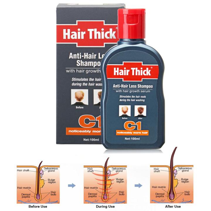 Anti-hair%20Loss%20Shampoo%20Thick%20Dexe%20100ml%20C1%20Hair%20Growth%20Serum%20Hair%20Loss%20Shampoo%20-%20-%20Image%205