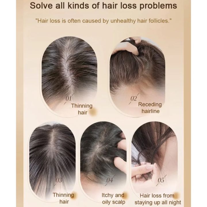 Late%20Night%20PartyPlant%20Extract%20Ginger%20Anti-hair%20Loss%20and%20Hair%20Care%20Shampoo%20Hair%20Growth%20and%20Conditioning%20Shampoo%20%E7%94%9F%E5%A7%9C%E6%A4%8D%E8%90%83%E9%98%B2%E8%84%B1%E8%82%B2%E5%8F%91%E6%B4%97%E5%A4%B4%E8%86%8F%20-%20Image%202