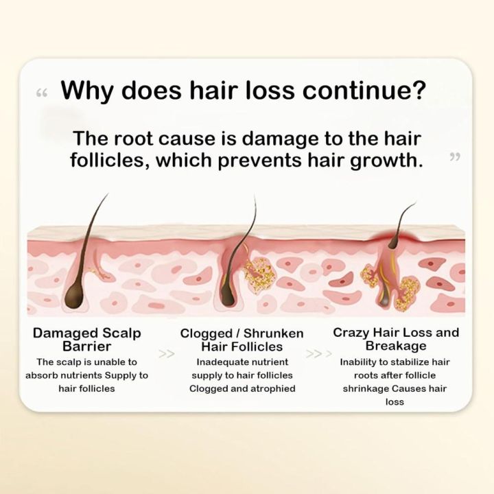 Late%20Night%20PartyPlant%20Extract%20Ginger%20Anti-hair%20Loss%20and%20Hair%20Care%20Shampoo%20Hair%20Growth%20and%20Conditioning%20Shampoo%20%E7%94%9F%E5%A7%9C%E6%A4%8D%E8%90%83%E9%98%B2%E8%84%B1%E8%82%B2%E5%8F%91%E6%B4%97%E5%A4%B4%E8%86%8F%20-%20Image%204