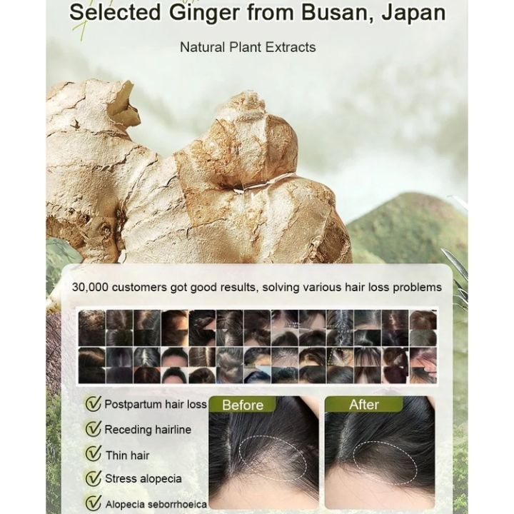 Late%20Night%20PartyPlant%20Extract%20Ginger%20Anti-hair%20Loss%20and%20Hair%20Care%20Shampoo%20Hair%20Growth%20and%20Conditioning%20Shampoo%20%E7%94%9F%E5%A7%9C%E6%A4%8D%E8%90%83%E9%98%B2%E8%84%B1%E8%82%B2%E5%8F%91%E6%B4%97%E5%A4%B4%E8%86%8F%20-%20Image%206