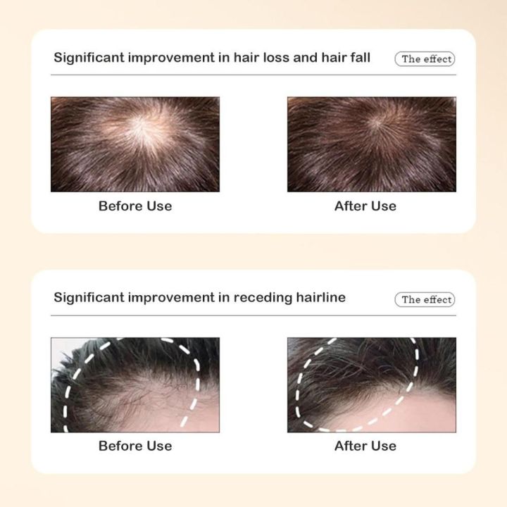 Late%20Night%20PartyPlant%20Extract%20Ginger%20Anti-hair%20Loss%20and%20Hair%20Care%20Shampoo%20Hair%20Growth%20and%20Conditioning%20Shampoo%20%E7%94%9F%E5%A7%9C%E6%A4%8D%E8%90%83%E9%98%B2%E8%84%B1%E8%82%B2%E5%8F%91%E6%B4%97%E5%A4%B4%E8%86%8F%20-%20Image%203