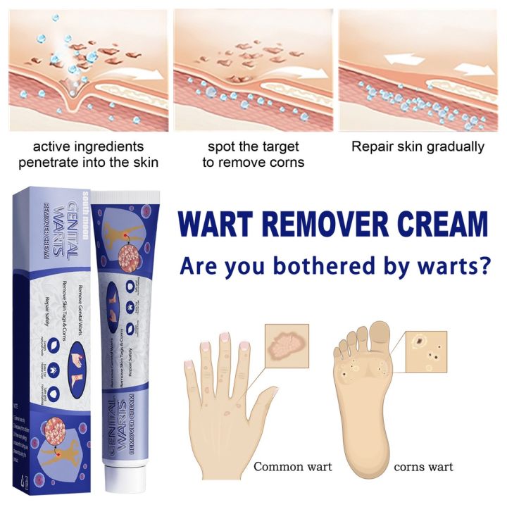 Relax%20day%20Skin%20Tag%20Wart%20Removal%20ubat%20buang%20ketuat%20kaki%20Wart%20Remover%20Cream%20Tag%20Solution%20Skin%20Tag%20Mole%20Buang%20Tahi%20Lalat%20Ketuat%20Kutil%20Traditional%20Natural%20Mole%20Ubat%20buang%20kutil%20ketuat%20tahi%20lalat%20biji%20kolestrol%20Traditional%20Mole%20Removal%20Pembuang%20Tahi%20Lalat%20Semu%20-%20Image%207