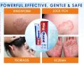Ring Guard Anti Fungal Cream 20gm. 