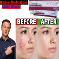 Genbet cream 15g. 