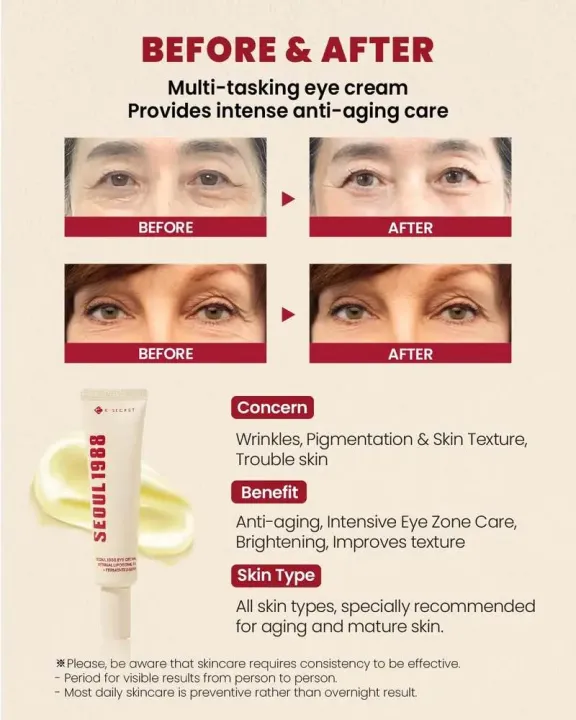 KSECRET%20SEOUL%201988%20EYE%20CREAM%20:%20RETINAL%20LIPOSOME%204%25%20+%20FERMENTED%20BEAN%2030ML%20-%20Image%203