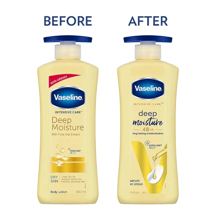 Vaseline%20Intensive%20Care%20Deep%20Moisture%20Nourishing%20Body%20Lotion%20400%20ml,%20Daily%20Moisturizer%20for%20Dry%20Skin,%20Gives%20Non-Greasy,%20Glowing%20Skin%20-%20For%20Men%20&%20Women%20-%20Image%202