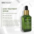 Breylee & Feny Acne Treatment set 4pcs Combo (Serum/Cream/Cleanser/Toner). 