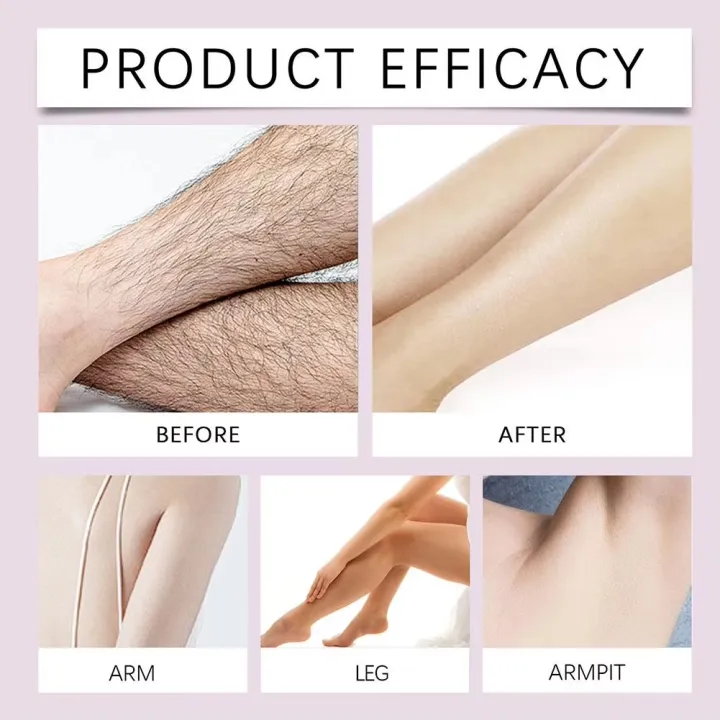 2%20Minutes%20Painless%20Fast%20Hair%20Removal%20Spray%20Hair%20Growth%20Inhibitor%20Arm%20Armpit%20Leg%20Permanent%20Depilatory%20for%20Men%20Women%20Repair%20Care%20-%20Image%206