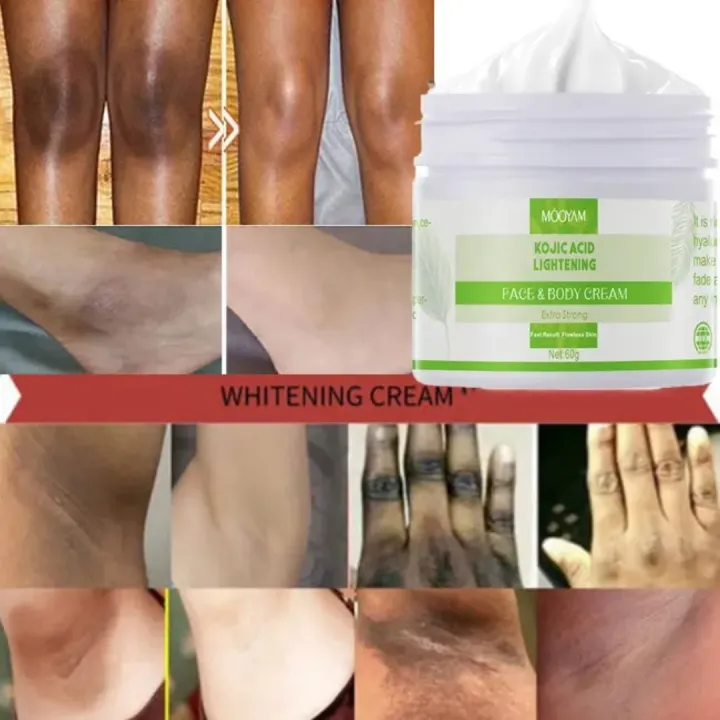 MOOYAM%20Kojic%20Acid%20Lightening%20Face%20&%20Body%20Cream%20(60g)%20-%20Image%202