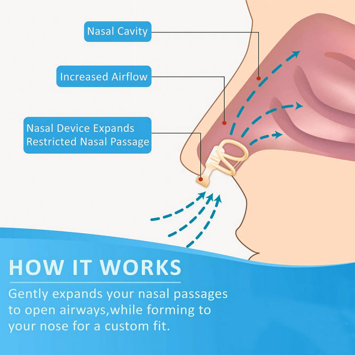 Nose%20Dilator%20Nasal%20Silicone%20Nose%20Clip%20Anti%20Snoring%20Easy%20Breath%20Preventing%20Snoring%20Help%20Breathe%20Snoring%20Devices%20Improve%20Sleeping%20-%20Image%204
