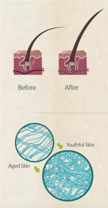Biosil%20advanced%20collagen%20generator%20-%20Image%203