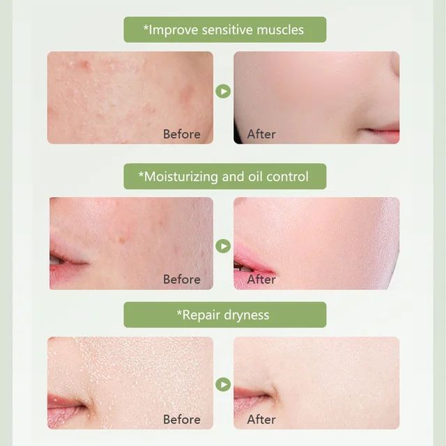 Aloe%20Vera%2099%25%20Moisturize%20Shooting%20Gel%20-%20Image%203