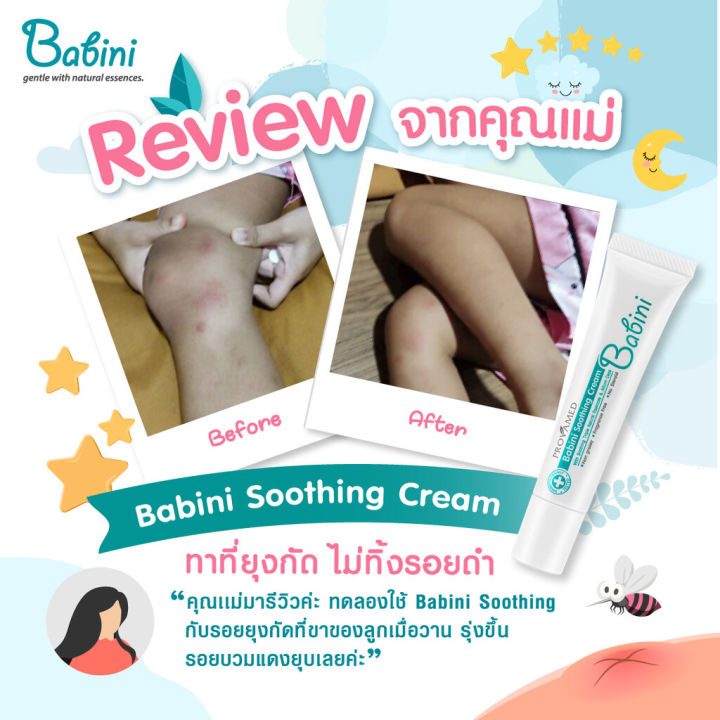 Provamed%20Babini%20Soothing%20Cream%20%5BProduct%20Available%20in%202%20Sizes%5D%20Skin%20Cream%20for%20Children,%20Rashes,%20and%20Hives.%20-%20Image%204
