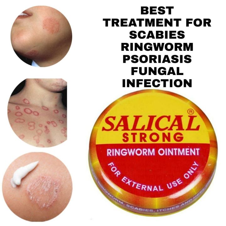 Salical%20Strong%20Ringworm%20Ointment%20Cream%2015g%20(indian)%20-%20Image%203