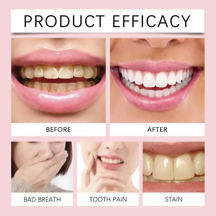 Oralhoe%20SP-6%20Super%20Probiotic%20Bright%20White%20Toothpaste%20-%20120g/4.23oz%20-%20Image%207
