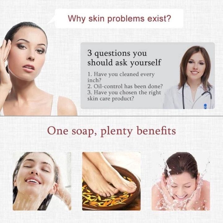 Zudaifu%20sulfur%20soap%2080g%20100%25%20genuine%20zudaifu%20sulfur%20soap%20natural%20herbal%20soap%20sulfur%20skin%20care%20soap%20body%20wash%20acne%20care%20soap%20whitening%20natural%20wash%20bath%20-%20Image%204