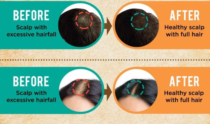 Indulekha%20Bringha%20Hair%20Oil%20100ml%20(%20imported%20100%20%25%20Authentic%20product)%20-%20Image%206