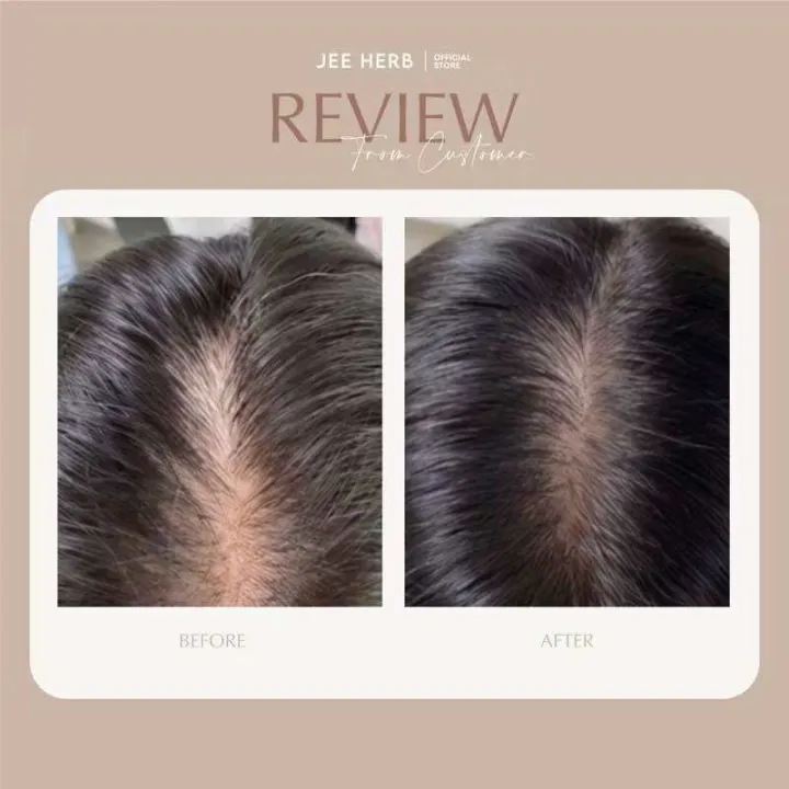 %5BBuy%201%20Get%201%20Free%5D%20Jee%20Herb%20Jee%20Herb%20Serum%20Jee%20Herb%20Serum%20Hair%20Tonic%20Serum%20Ghee%20Herb%20Shampoo%20Hair%20Care%20Serum%20-%20Image%207