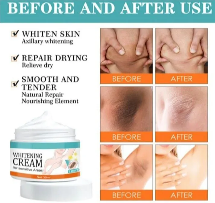 Facial%20&%20Body%20Whitening%20Cream%20for%20Brightening%20&%20Spot%20Removal%20-%20Moisturizing%20Skin%20Lightener%20for%20Sensitive/Mixed/Oily%20Skin%20-%20Image%203