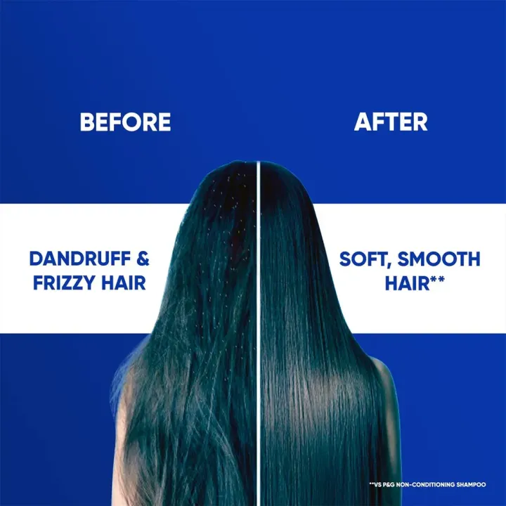 Head%20&%20Shoulders%20Anti%20Dandruff%20Shampoo%20Cool%20Menthol%20650ml%20-%20Image%206