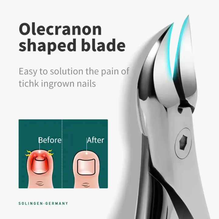 MR.GREEN%20Toenail%20Clippers%20Nail%20Cutters%20Professional%20Pedicure%20Ingrown%20nail%20Tools%20Anti-Splash%20Manicure%20Sets%20Stainless%20Steel%20-%20Image%202