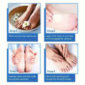 SUYARUN 60% Urea Foot Cream for Cracked Heels & Dry Skin - Intensive Moisturizing Treatment, Callus Remover, Diabetic Foot Care. freshfeet. 