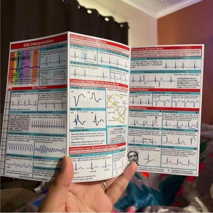 Ekg Rhythm Pocket Cards Ecg Interpretation Pocket Card Horizontal ...