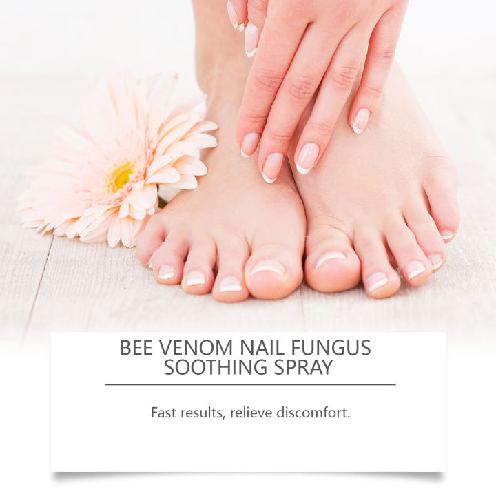 Bee%20Venom%20Nail%20Fungus%20Repair%20Spray%20Gray%20Nail%20Treatment%20Onychomycosis%20Paronychia%20Removal%20Relieve%20Foot%20Odor%20Hand%20Foot%20Nail%20Care%20freshfeet%20-%20Image%205