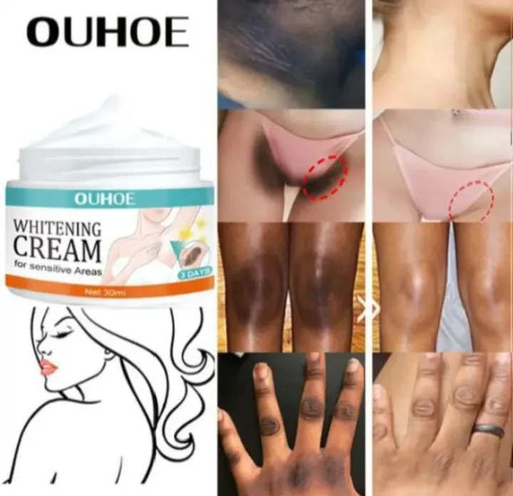 Whitening%20cream%20for%20private%20parts%20and%20sensitive%20area%20underarm%207%20days%20result%20cream%20-%20Image%202