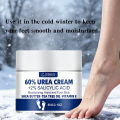 JUINHOU 60%Urea Foot Cream for Cracked Heels Dry Skin Intensive Moisturizing Treatment Callus Remover Smooth Skin Daily Foot Car.