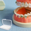 5Pcs/Box Dental Orthodontics Ortho Wax Mint Mix Scent For Braces Bracket Gum Irritation Teeth Oral Hygiene Tools.