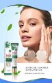 Tea tree acni oil control gell special Treatment. 