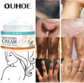Whitening cream for private parts and sensitive area underarm 7 days result cream. 