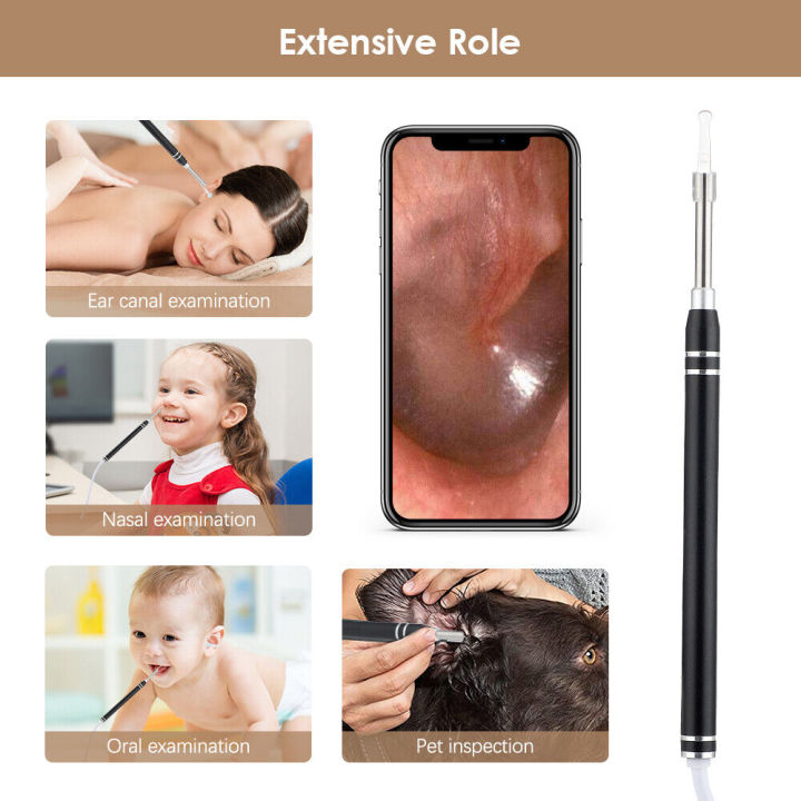 Self-service%20Ear%20Cleaning%20Endoscope%20Set%20Wireless%20Intelligent%20ear%20cleaner%20Earwax%20Remover%20HD%20Camera%20Ear%20Cleaner%20for%20the%20elderly%20-%20Image%205