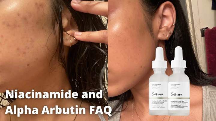 The%20Ordinary%20Niacinamide%20+%20Alpha%20Arbutin%20Combo%20-%20Image%202