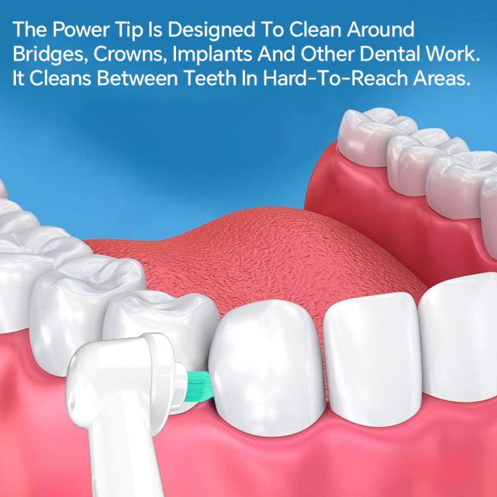 2pcs%20Compatible%20with%20Oral%20B%20Electric%20Toothbrush%20Replacement%20Brush%20Heads,%20Interdental%20Toothbrush%20Heads%20for%20Cleaning%20Between%20Teeth%20-%20Image%205
