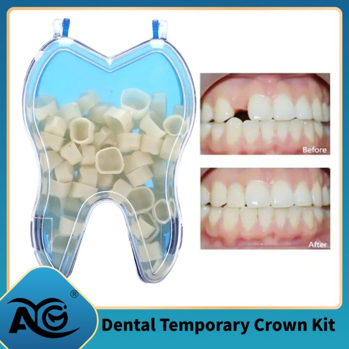 AG 50 Pcs/Box Dental Temporary Crown Kit Anterior Front Molar Posterior Teeth Veneers Dentistry Tooth  Dental Tools