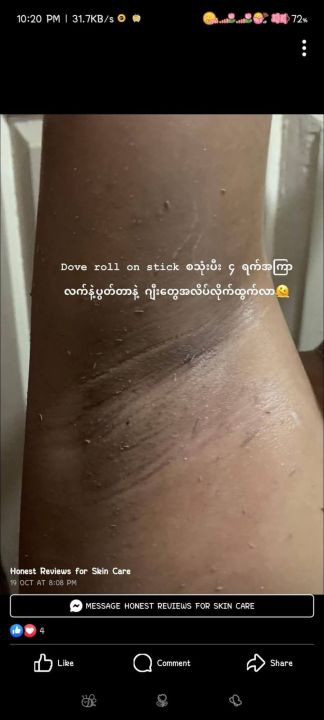 Dove%20Ultimate%20Repair%20Darkmarks%20Corrector%20Roll%20On%20Stick%20%7B%20Uk%20Made%20%7D%20-%20Image%203