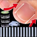 1-100PCS Ingrown Toenail Correction Ultra-thin Nail Treatment Elastic Patch Sticker Straightening Nails Groove Ingrown Corrector.
