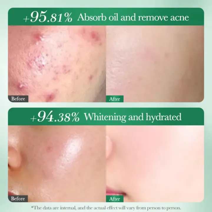 SADOER%20Whitening%20and%20Acne%20Removal%20Facial%20Cleanser,%20Net%20100g%20-%20Image%203