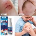 Rapid Hemostasis Wound Spray Instant Scab Formation Waterproof Antibacterial Protective Film Non Irritating Formula for Adults. 
