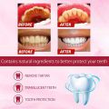 Sp-4 Brightening Toothpaste, toothpaste for cavity repair Fresh Breath,sp4 rapid relief toothpaste; sensitive toothpaste, Whitening, 30 gm,. 