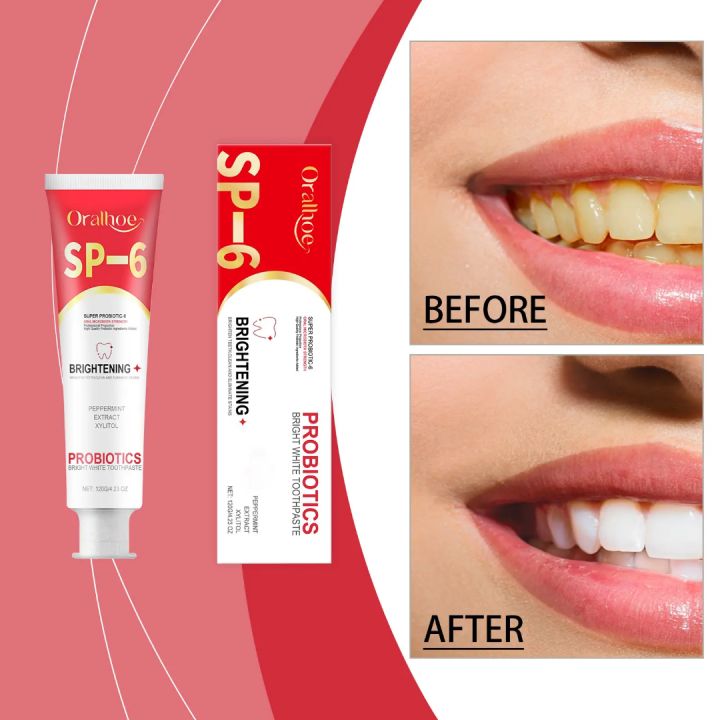 Oralhoe%20SP-6%20Brightening%20+%20PROBIOTICS%20Bright%20White%20Toothpaste%20-%20Image%203