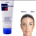 Mistine Acne Clear Facial Foam Face Wash 85g. 