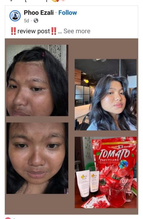 Tomato%20Gluta%20&%20Collagen%20Supplement%20-%20Image%202