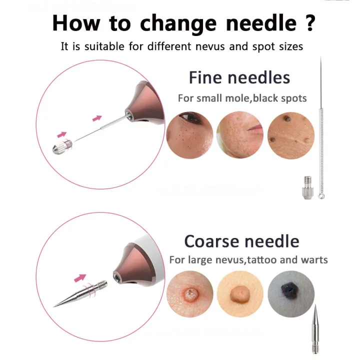 Plasma%20Pen%20Skin%20Tag%20Remover%20Mole%20Removal%20Wart%20Spots%20Dark%20Dpot%20Black%20Dot%20Nevus%20Freckle%20Flat%20Blemish%20Pimples%20Removal%20for%20Face%20Body%20-%20Image%207